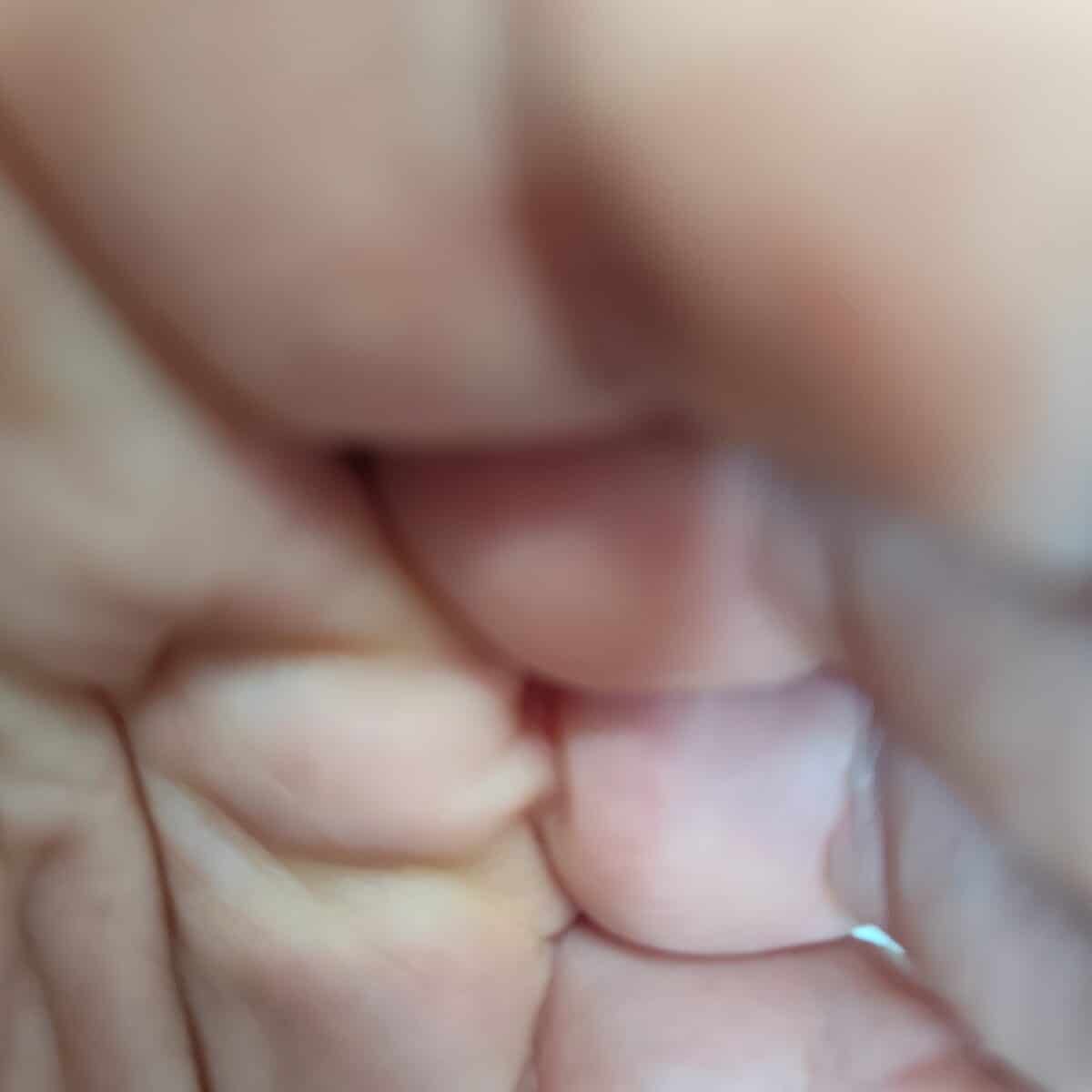 1000028361